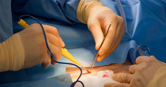 two surgeons operating