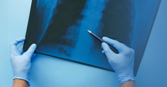 doctor pointing at an x-ray with pen